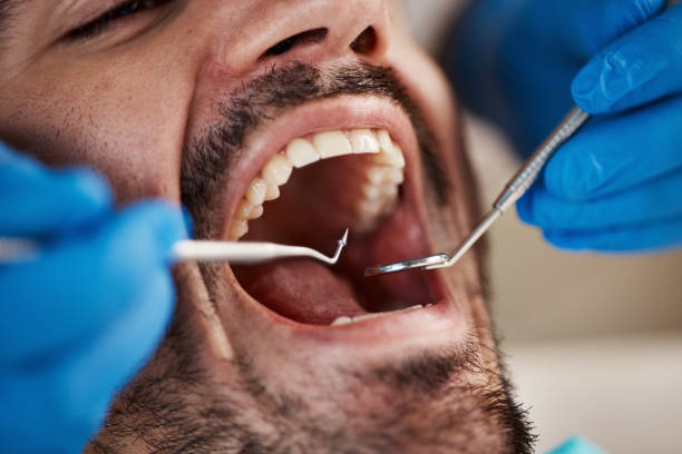 Best Emergency Treatment for Dental Infections or Abscesses in Eminence, KY